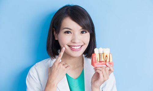 a dentist smiling and holding a dental implant model